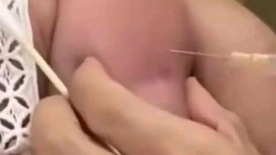 江苏一护士戴手链美甲给宝宝打疫苗针头全扎胳膊引争议 卫生院回应涉事护士暂调岗