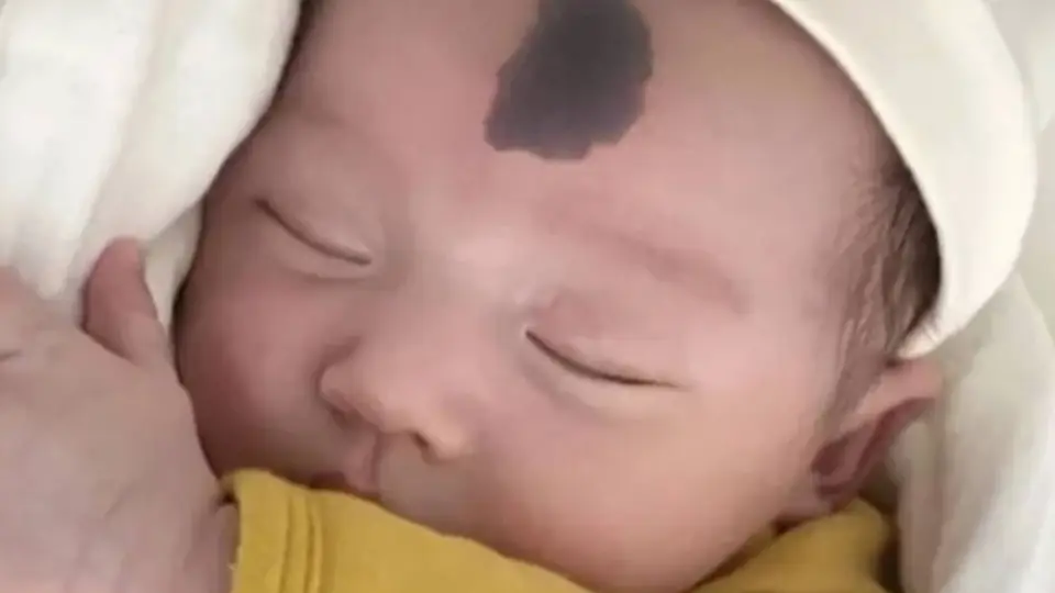孕期这样做 远离宝宝胎记烦恼 准妈们要记牢这4点