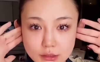 网红婉儿医美翻车，自嘲“关了美颜像孙猴子”