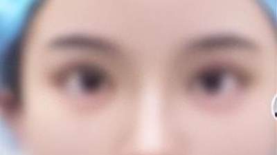 未成年人沉迷网络畸形审美追捧网红脸 找朋友冒充家长做医美隐患多