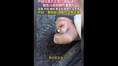 珠海产检全程顺利生下的宝宝却双脚严重畸形，家属质疑检查不细，院方称属医学盲区无责，超声科医生坦言四肢末端畸形难排查