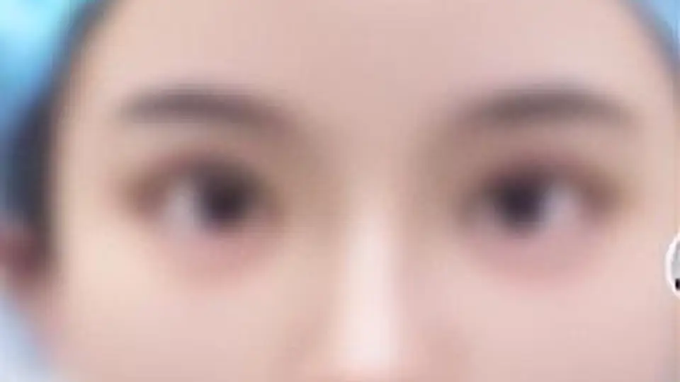 未成年人沉迷网络畸形审美追捧网红脸 找朋友冒充家长做医美隐患多