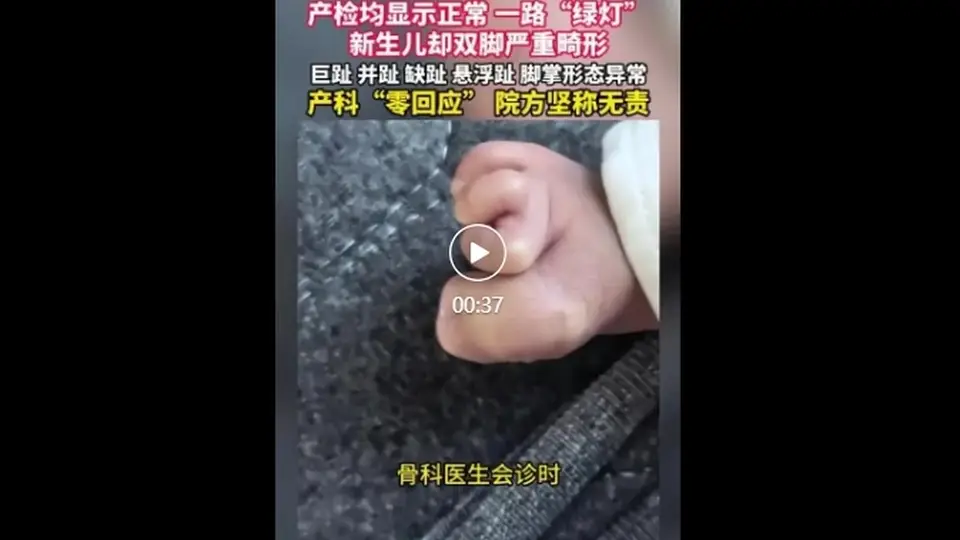 珠海产检全程顺利生下的宝宝却双脚严重畸形，家属质疑检查不细，院方称属医学盲区无责，超声科医生坦言四肢末端畸形难排查