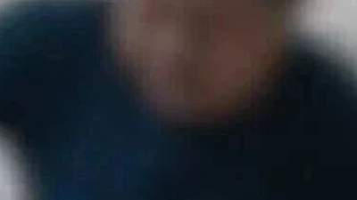 60岁女子绝经7年后再出血，检查竟发现双子宫、双宫颈；一辈子不孕不育，从未做过B超检查